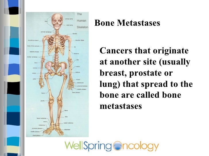 breast bone metastasis Femdom genital torture